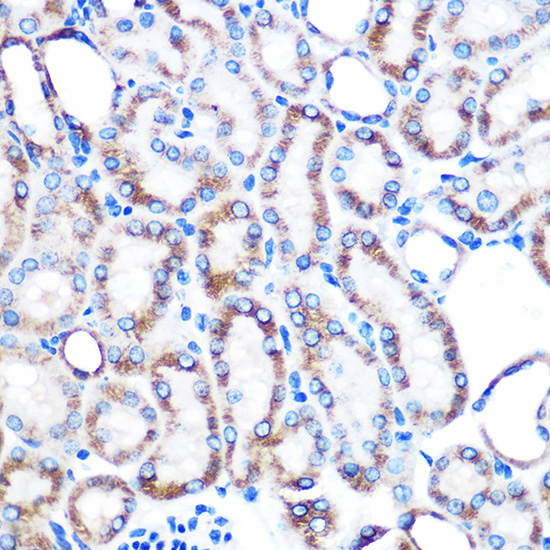 Lumican (LUM) Rabbit Monoclonal Antibody - Image 3