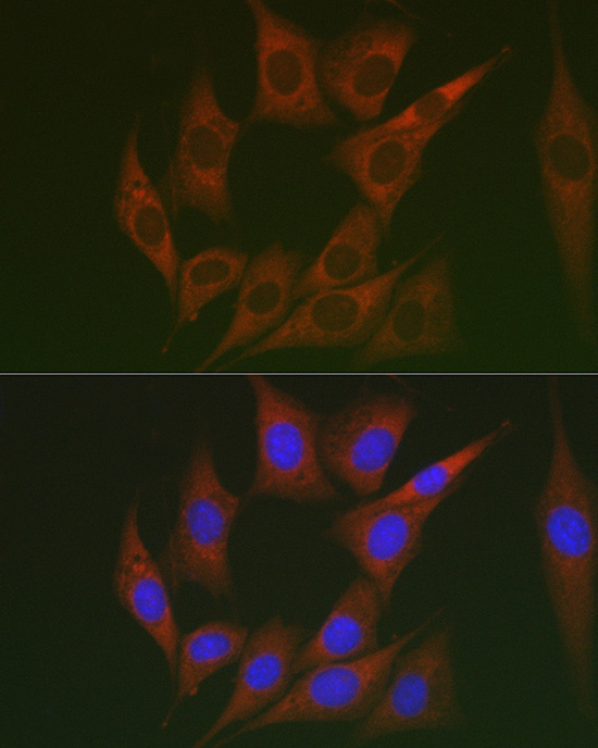 Lumican (LUM) Rabbit Polyclonal Antibody - Image 2