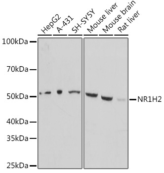 LXR beta/NER Rabbit Polyclonal Antibody