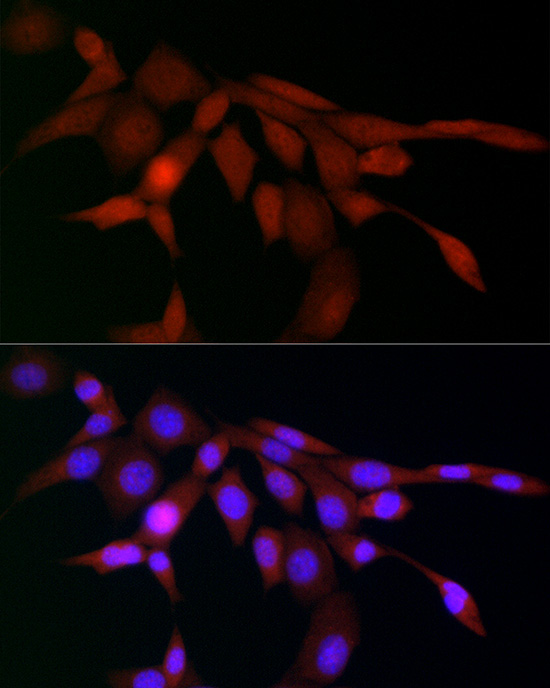 LXR beta/NER Rabbit Polyclonal Antibody - Image 2