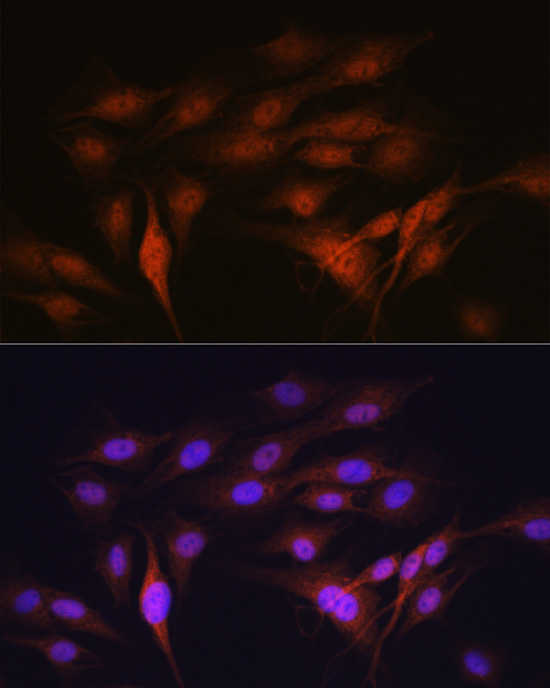LXRAlpha Rabbit Monoclonal Antibody - Image 2