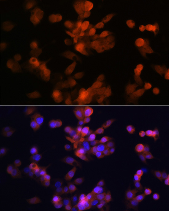 LXRAlpha Rabbit Monoclonal Antibody - Image 3
