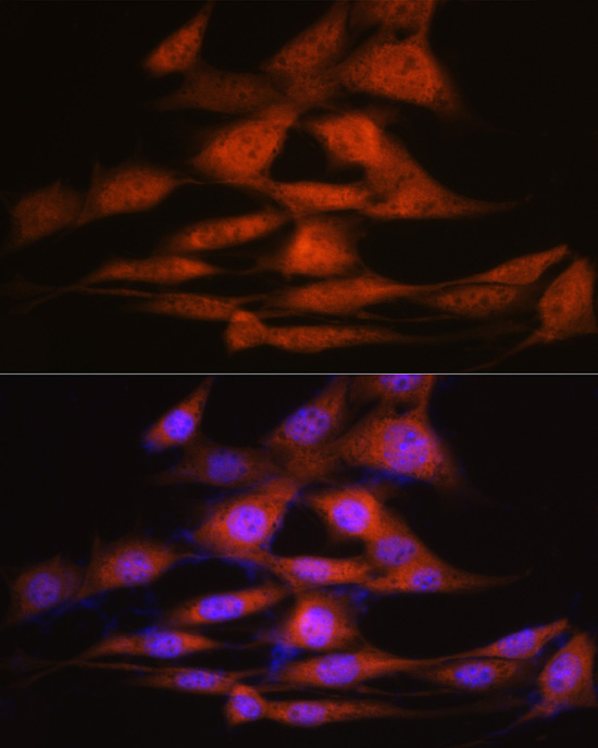 LXRAlpha Rabbit Monoclonal Antibody - Image 4