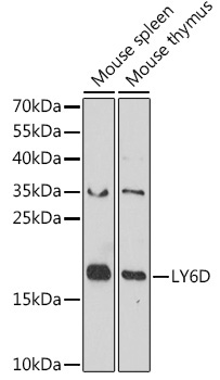 LY6D Rabbit Polyclonal Antibody