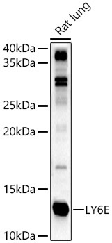 LY6E Rabbit Polyclonal Antibody