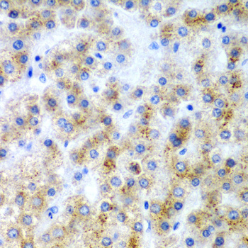 LY86 Rabbit Polyclonal Antibody - Image 2