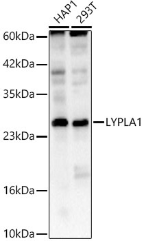 LYPLA1 Rabbit Polyclonal Antibody