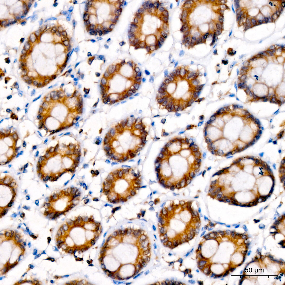 LYPLA1 Rabbit Polyclonal Antibody - Image 2