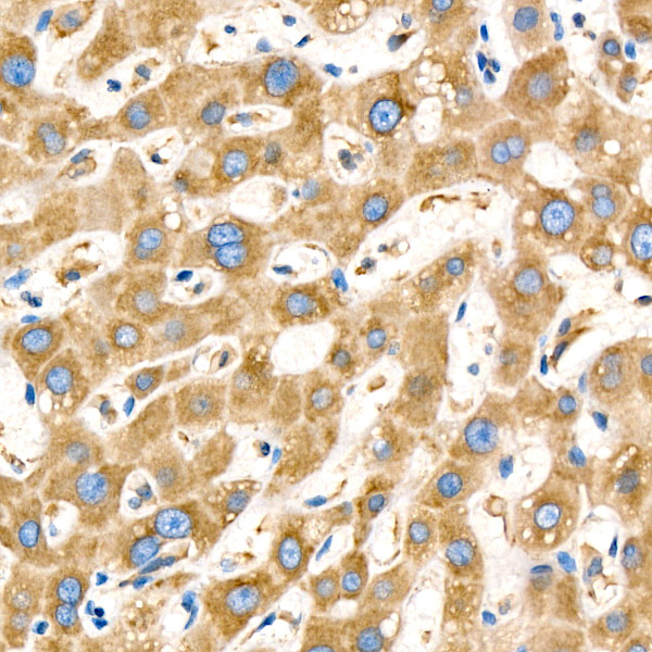 LYRIC/AEG1 Rabbit Monoclonal Antibody