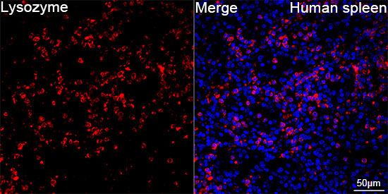 Lysozyme (LYZ) Rabbit Monoclonal Antibody - Image 2