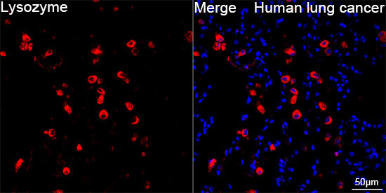 Lysozyme (LYZ) Rabbit Monoclonal Antibody - Image 3