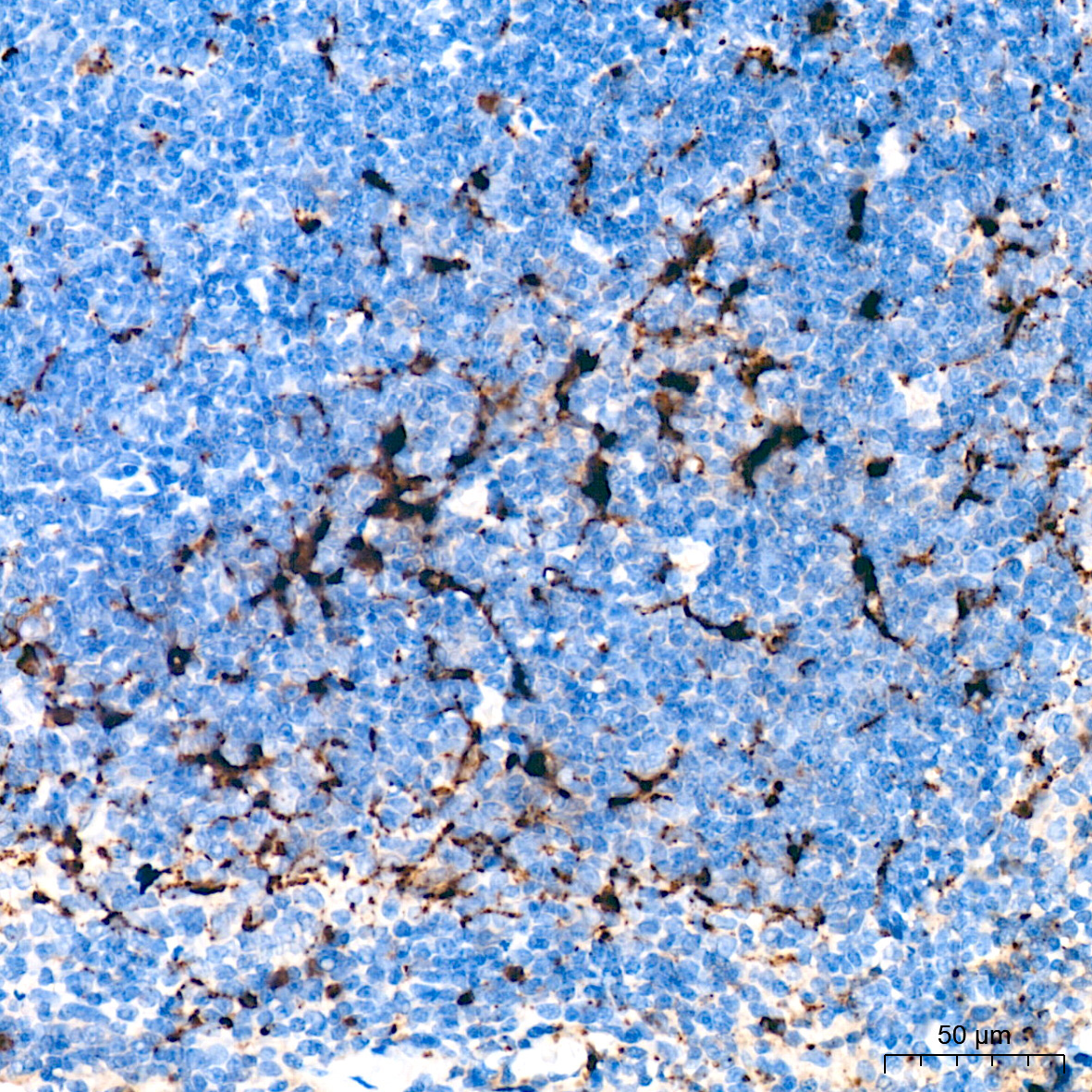 Lysozyme (LYZ) Rabbit Monoclonal Antibody - Image 2