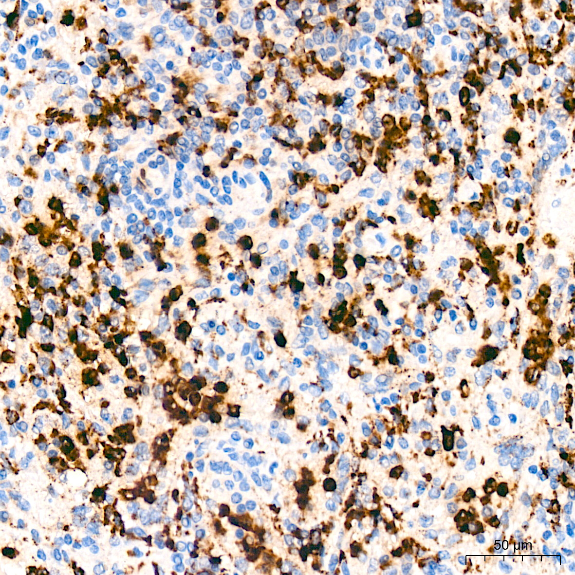 Lysozyme (LYZ) Rabbit Monoclonal Antibody - Image 3