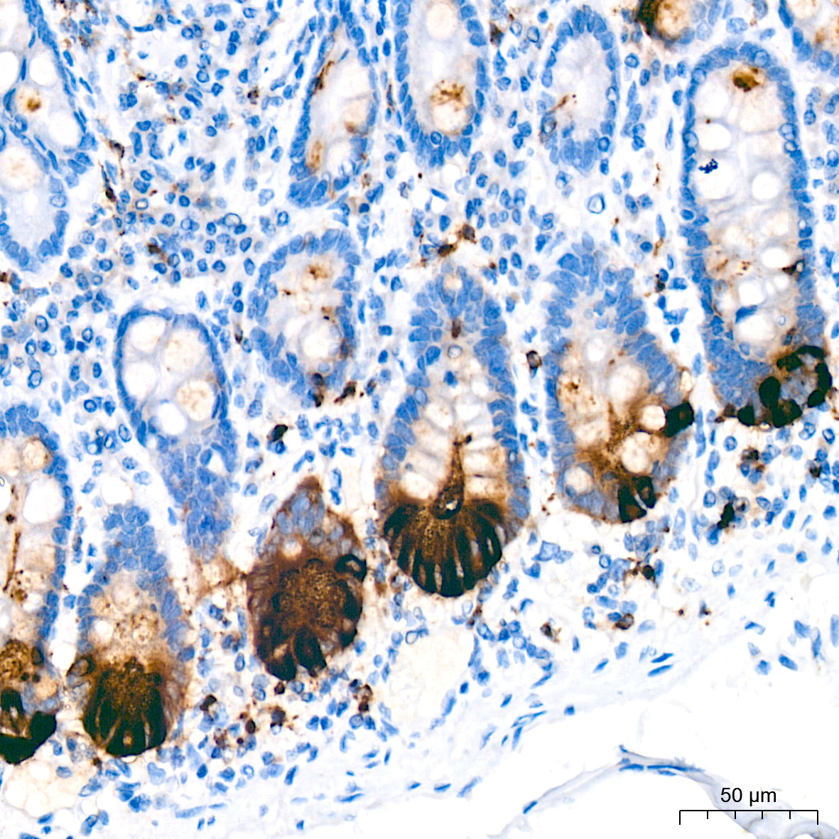 Lysozyme (LYZ) Rabbit Monoclonal Antibody - Image 4