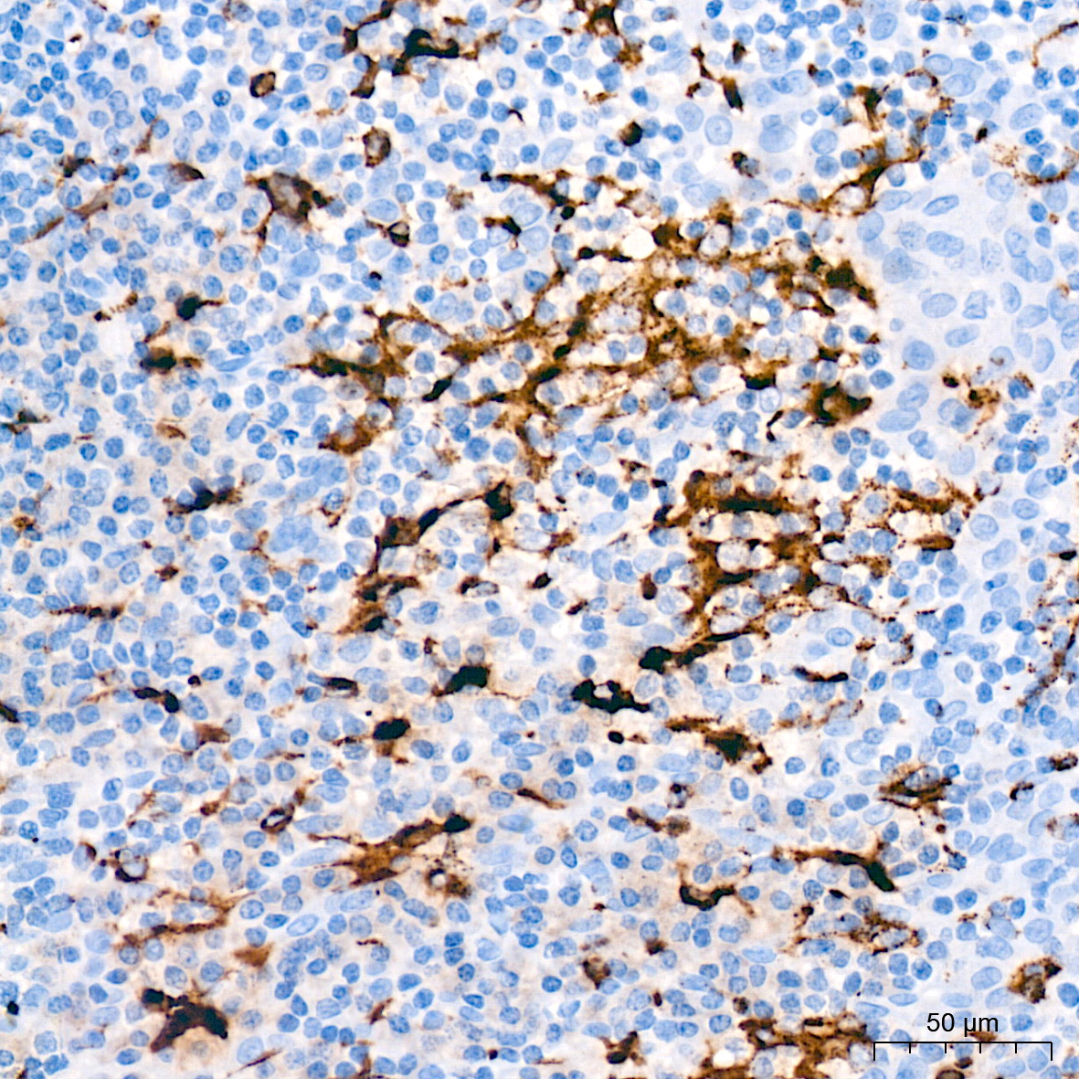 Lysozyme (LYZ) Rabbit Monoclonal Antibody - Image 5