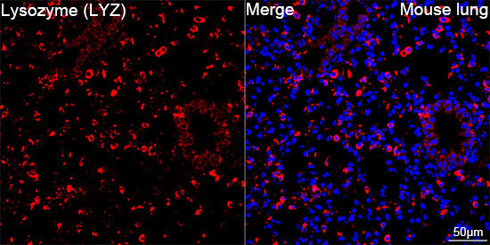 Lysozyme (LYZ) Rabbit Monoclonal Antibody - Image 7