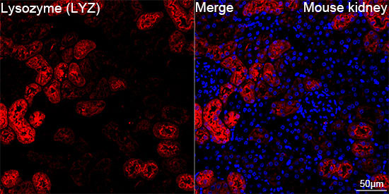 Lysozyme (LYZ) Rabbit Monoclonal Antibody - Image 8