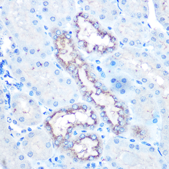 Lysozyme (LYZ) Rabbit Polyclonal Antibody - Image 3