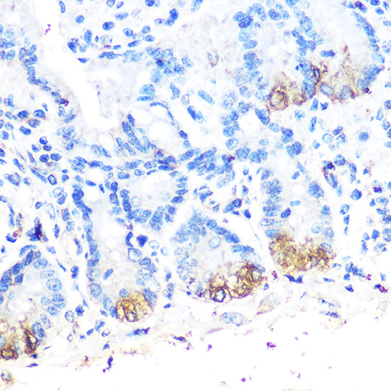 Lysozyme (LYZ) Rabbit Polyclonal Antibody - Image 4