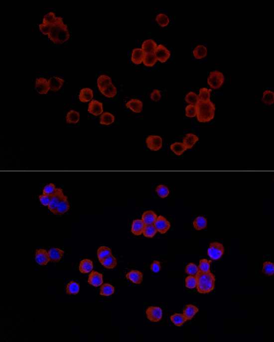 Lysozyme (LYZ) Rabbit Polyclonal Antibody - Image 5