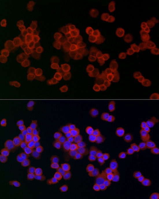 Lysozyme (LYZ) Rabbit Polyclonal Antibody - Image 6