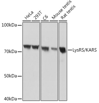 LysRS/KARS Rabbit Monoclonal Antibody