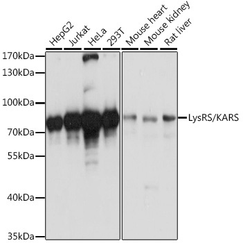 LysRS/KARS Rabbit Polyclonal Antibody