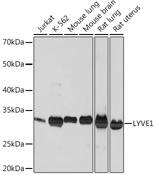 LYVE1 Rabbit Monoclonal Antibody