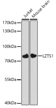 LZTS1 Rabbit Polyclonal Antibody - Image 2