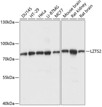 LZTS2 Rabbit Polyclonal Antibody