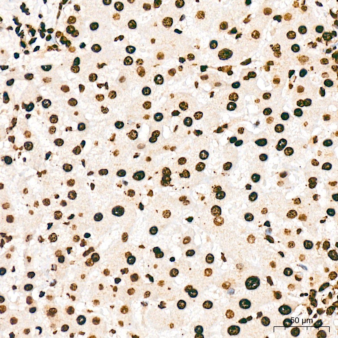 macroH2A.1 Rabbit Monoclonal Antibody - Image 3