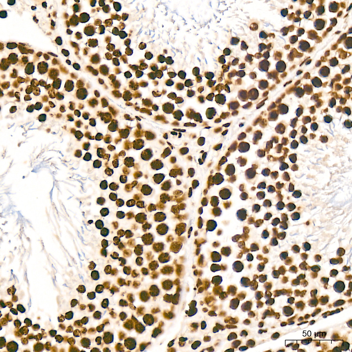 macroH2A.1 Rabbit Monoclonal Antibody - Image 4