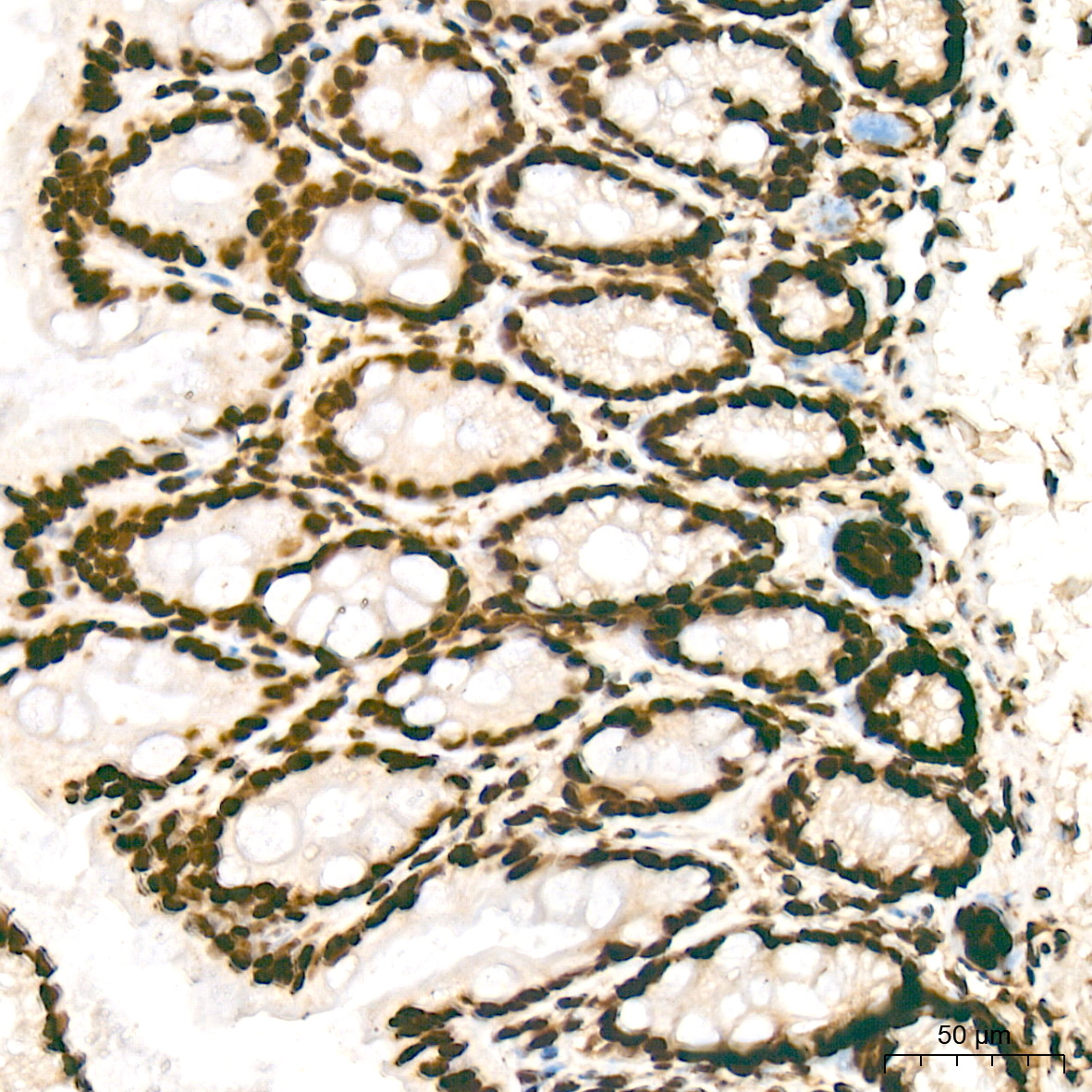 macroH2A.1 Rabbit Monoclonal Antibody - Image 5