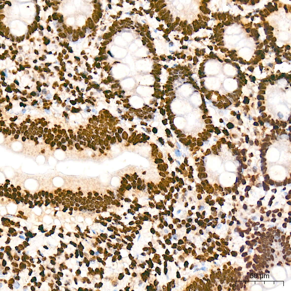 macroH2A.1 Rabbit Monoclonal Antibody - Image 6