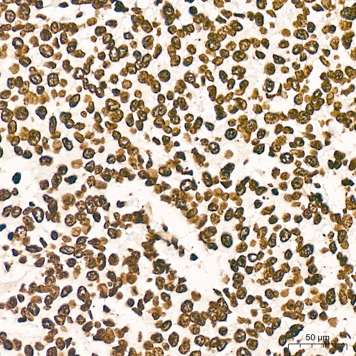 macroH2A.1 Rabbit Monoclonal Antibody - Image 7