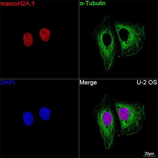 macroH2A.1 Rabbit Monoclonal Antibody - Image 8