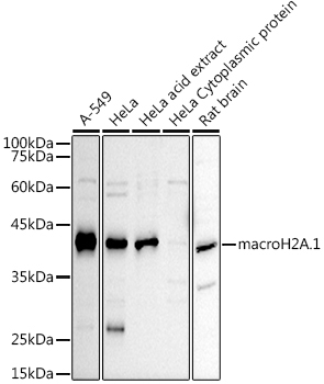 macroH2A.1 Rabbit Polyclonal Antibody