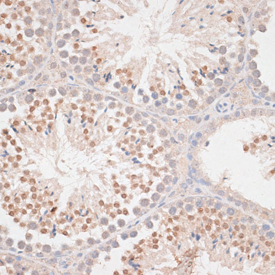 MAD2/MAD2L1 Rabbit Polyclonal Antibody