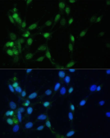 MAD2/MAD2L1 Rabbit Polyclonal Antibody - Image 2