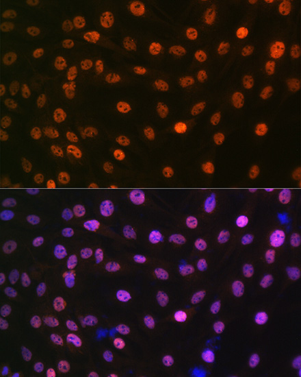 MAD2B/MAD2L2 Rabbit Monoclonal Antibody - Image 2