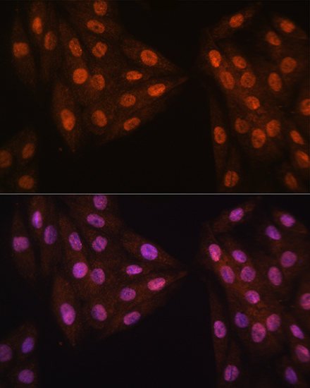 MAD2B/MAD2L2 Rabbit Polyclonal Antibody - Image 2