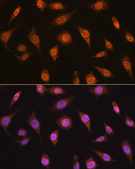 MAD2B/MAD2L2 Rabbit Polyclonal Antibody - Image 3