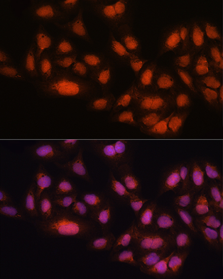 MAD2B/MAD2L2 Rabbit Polyclonal Antibody - Image 4