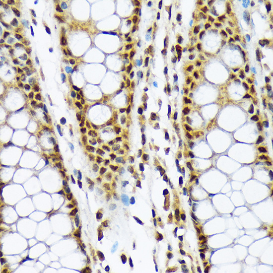 MAD2L1BP Rabbit Monoclonal Antibody