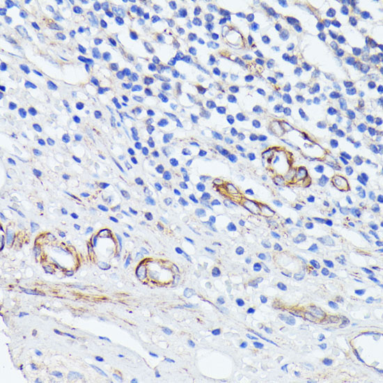 MADCAM1 Rabbit Polyclonal Antibody - Image 2