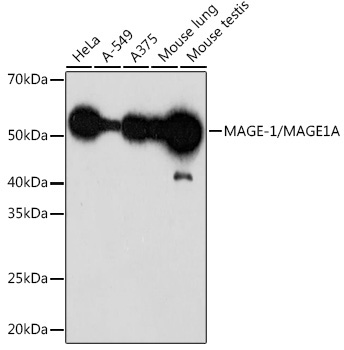 MAGE-1/MAGE1A Rabbit Monoclonal Antibody