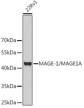 MAGE-1/MAGE1A Rabbit Polyclonal Antibody
