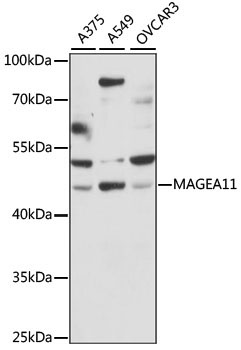 MAGEA11 Rabbit Polyclonal Antibody