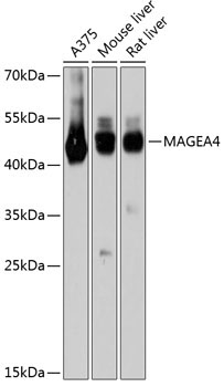 MAGEA4 Rabbit Polyclonal Antibody