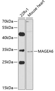 MAGEA6 Rabbit Polyclonal Antibody